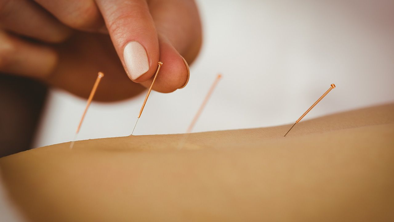 titel-akupunkturbehandlung-zumkurfuerstende-blog